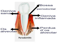 periodonto